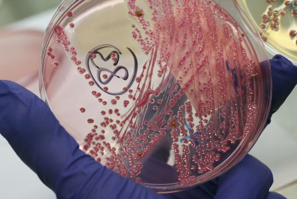 A lab technician holds a bacteria culture that shows a positive infection of E. col.